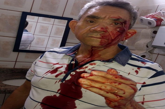 Professor agredido por aluno de 14 anos decide abandonar profissão