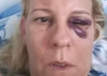 ‘Me achava culpada’, declara professora agredida durante quatro anos pelo ex