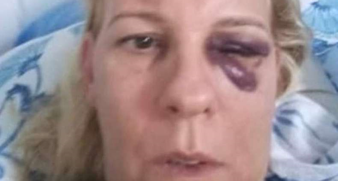 ‘Me achava culpada’, declara professora agredida durante quatro anos pelo ex