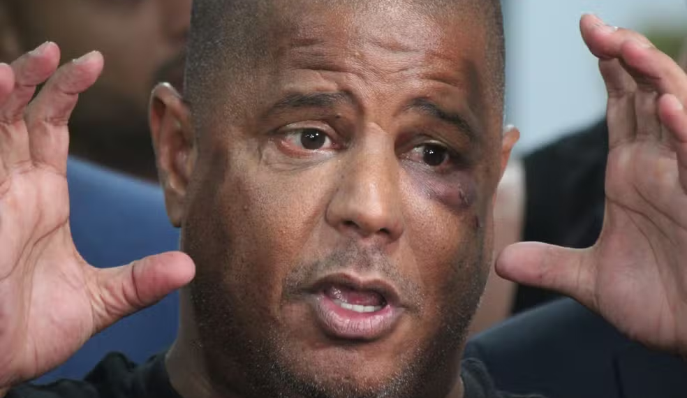 Em Depoimento à Polícia, Marcelinho Carioca Refuta Qualquer Conexão com Segunda Vítima